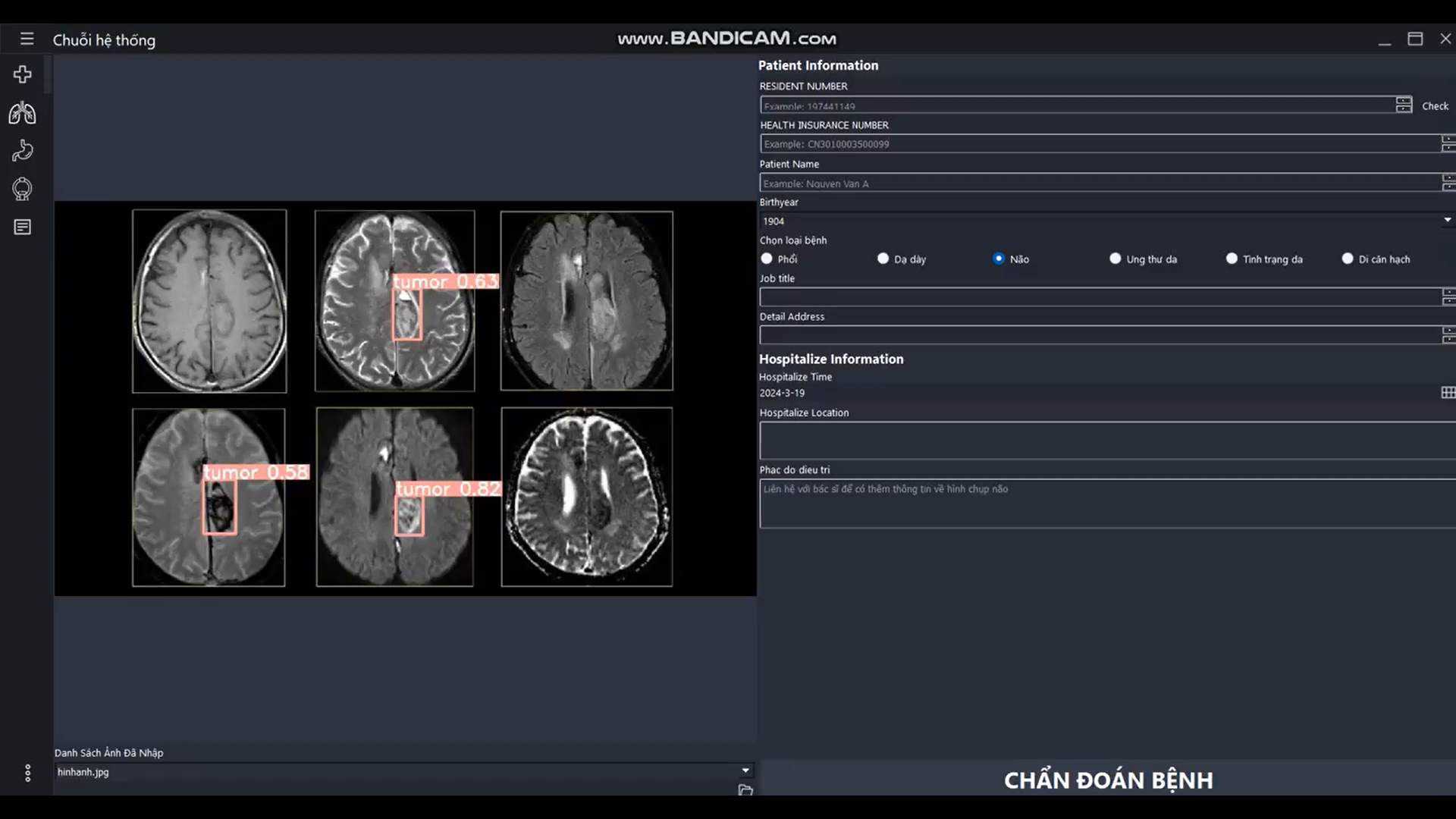Ứng dụng trí tuệ nhân tạo, deep learning và big data chẩn đoán bệnh qua hình chụp x-quang cho sinh viên y khoa